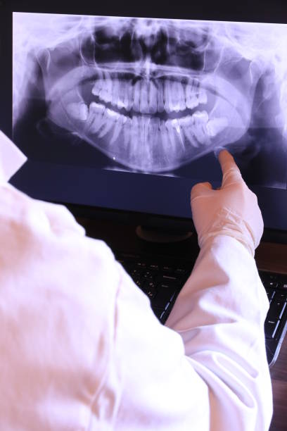 Best Emergency Wisdom Tooth Extraction in Ipswich, SD